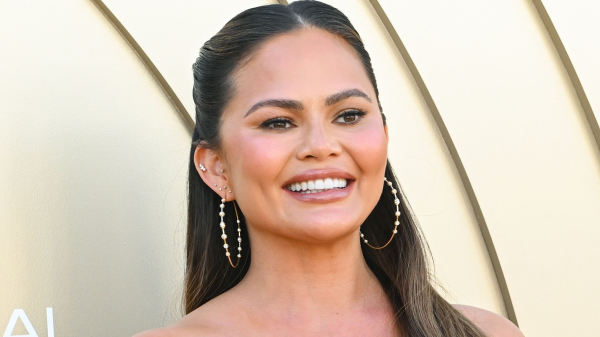 Chrissy Teigen Lost a Veneer, But She’s Still Smiling — See Photos